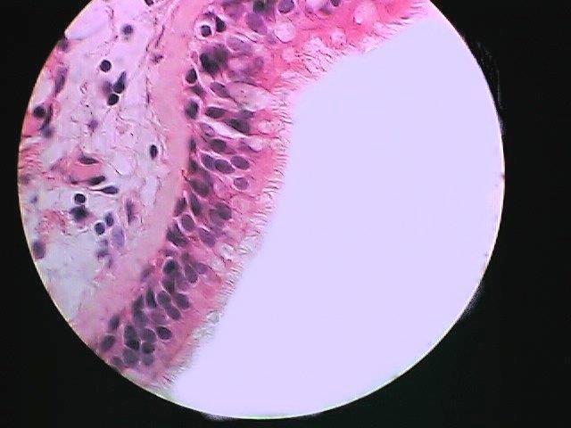 También se encuentran células ciliadas. Las cilios son especies de pelos en la superficie de la célula que tienen movimiento ondulatorio.