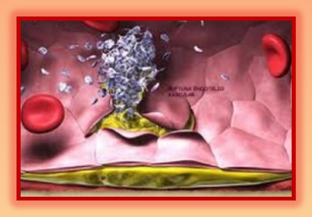 HEMOSTASIA Proceso fisiológico que mantiene la sangre en estado líquido, y a la vez evita la pérdida de sangre del interior de los vasos