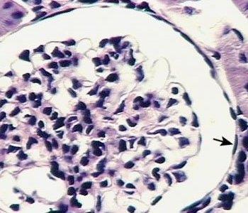 Clasificación de los epitelios. Según su función: o Epitelio de revestimiento. o Epitelio glandular. Según la forma de las células que lo componen: o Células planas. o Células cúbicas.