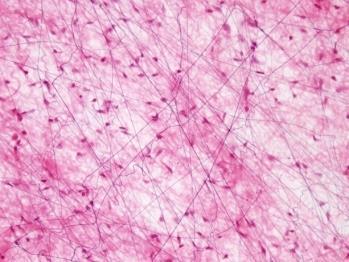 Los tejidos conectivos suelen clasificarse en: Tipos de tejidos conectivos Tipos Matriz Células principales Función Conjuntivo Fibras gruesas Fibrocitos Soporte Adiposo Escasa Adipocitos