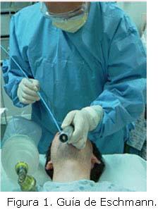 Cuando se presenta una situación en la que el anestesiólogo convencionalmente entrenado experimenta dificultad con la ventilación con máscara facial, dificultad con la intubación traqueal o ambas, es