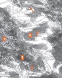 Micrografía que muestra varias células del estrato espinoso, su núcleo (1), prolongaciones
