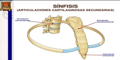 ARTICULACIONES DEL TRONCO Sincondrósicas (Articulación semimóvil): Presentes en los cuerpos de una serie de vértebras hasta el sacro.