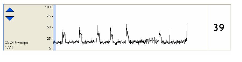 Analisis en dominio del tiempo Envolvente medida de amplitud del EEG, basada en el calculo de la mediana de la amplitud de la señal de EEG.