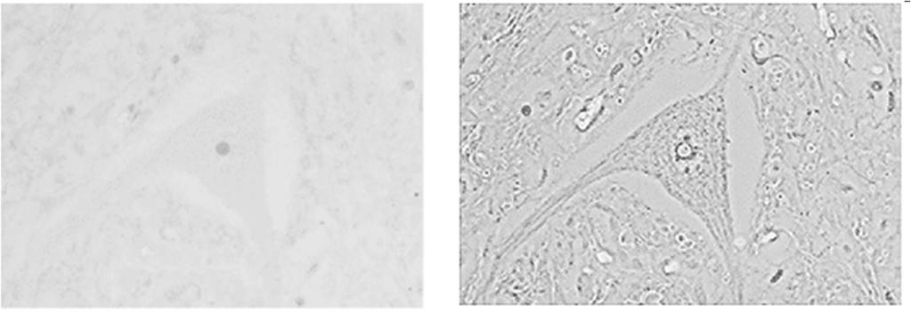 Técnicas especiales: microscopía de contraste de fase Micrografías de una neurona en campo claro (izquierda) con detalles casi invisibles y con iluminación de contraste de fases oscuro o positivo