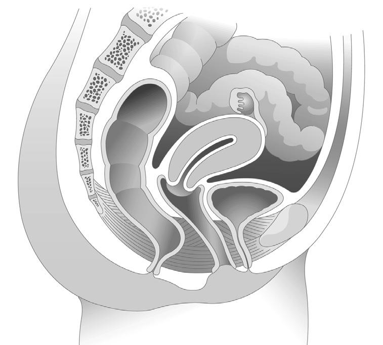 Anatomía normal de la mujer Ovario Trompa de Falopio Útero Intestino delgado Vejiga Tipos de problemas de apoyo pélvico Hay varios tipos de prolapso que llevan nombres distintos según la parte del