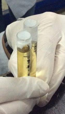 Examen químico 1. Vaciar un poco de orina en un tubo de ensayo (el recipiente debe estar totalmente limpio). 2.