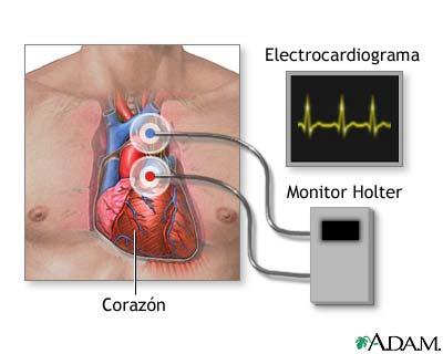 Es una máquina que registra los ritmos cardíacos en forma continua y