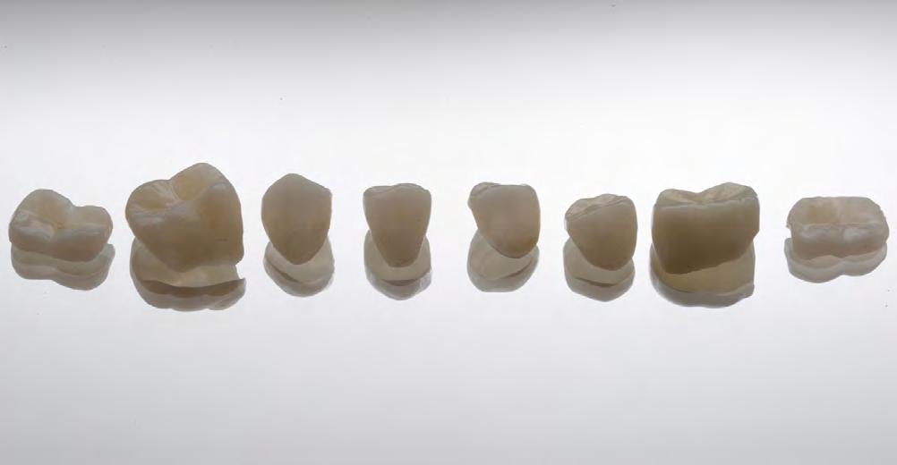 SEGUNDO DÍA PROGRAMA TEÓRICO Fundamentos clínicos y científicos de la Odontología mínimamente invasiva. Preparación/tallado para Carillas cerámicas.