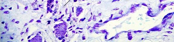 Organo Tejido Celula Inespecífica Edema, atrofia, hidrocefalia Inflamacion Alteraciones de la mielina Muerte celular Atrofia simple Específica Hemorragias Lesiomes