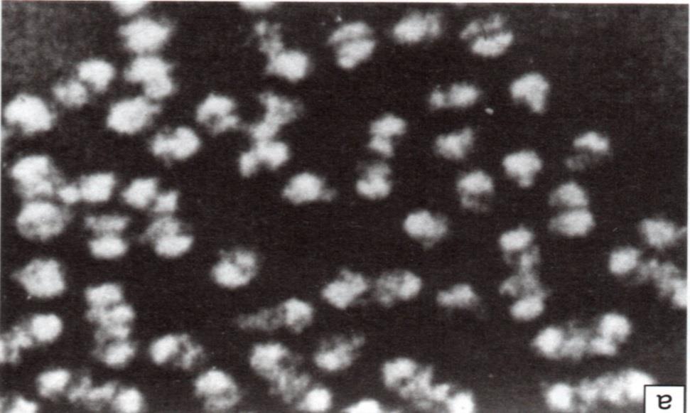 1- Ribosomas Partículas pequeñas, solamente visibles al microscopio electrónico, que se encargan de la