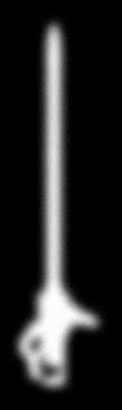Rectoscopio longitud de 250 mm, 20 mm Ø, con mandril ventanilla de cierre, lupa abatible y capuchón Rectoscopio longitud de 200 mm, 20 mm Ø, con mandril ventanilla