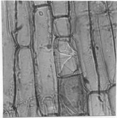 FIGURA 1. Schizolobium amazonicum. Cristales prismáticos en células parenquimáticas axiales (360 X). FIGURA 2. Schizolobium amazonicum. Drusas en células parenquimáticas radiales (360 X). FIGURA 3.