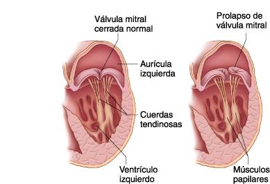 La aorta es la gran arteria que sale por arriba del ventrículo izquierdo y queda en íntima aposición con el lado derecho de la arteria pulmonar y algo detrás de ella.