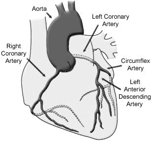 Arteria coronaria izquierda Arteria coronaria derecha Arteria circunfleja Arteria descendente anterior izquierda Válvula sigmoidea aórtica