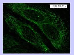 AC-16: Fibrilar Filamentoso Tinción Microtubulos y filamentos intermedios, se