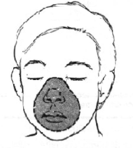 Máscara simple Proporciona FiO 2 del 35-50% con flujos de 6-10 lpm.