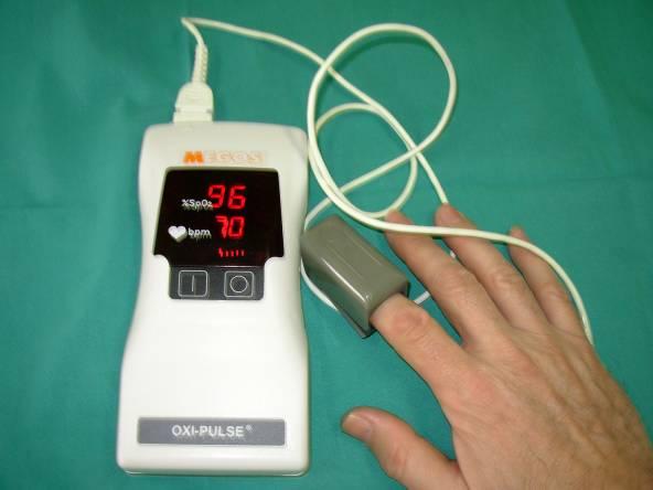 Monitorización del oxígeno en sangre 2. Pulsioximetría Es el método más empleado en la medición continua de la oxigenación arterial.