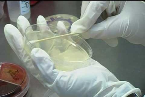 Antibiograma Un antibiograma es una técnica usada en microbiología para determinar sensibilidad y