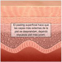 La dermis, o capa más interna de la piel, está conformada principalmente por tejido conectivo.