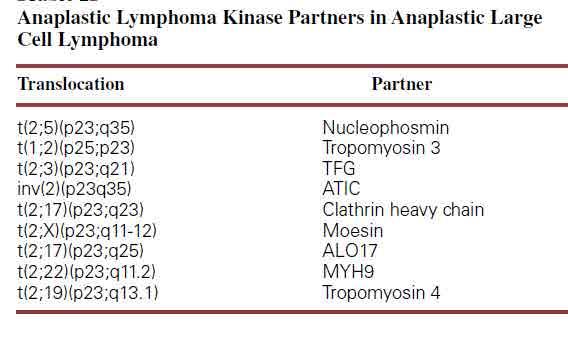 ALK Cinasa de linfoma anaplásico CD246 Gen ALK 2p23 Mutación mas frecuente con gen nuleofosmina (NPM) en 5q35 tinción en núcleo y