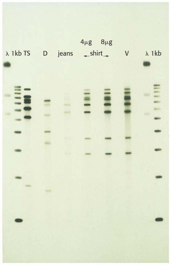 Ventajas de la PCR -Después de n ciclos la secuencia se amplifica 2 n veces -No es necesario conocer la secuencia a amplificar -Se necesita conocer