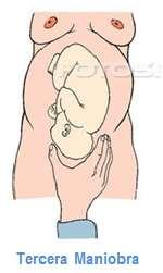 situación (longitudinal o transversa) fetal.