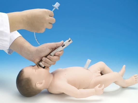 La intubación traqueal es uno de los procedimientos mas frecuentes en las Unidades de Cuidados Intensivos.