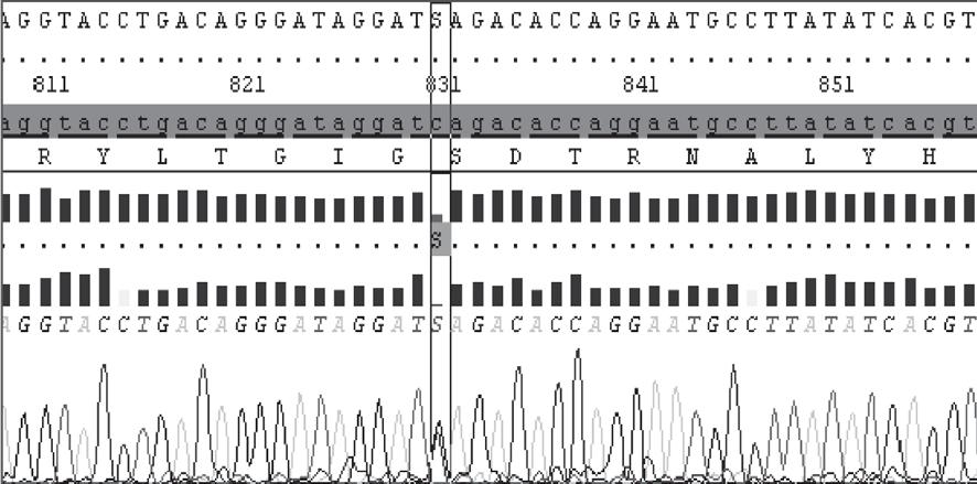 Figura 6. Cromatograma con secuenciación del gen EXT 1 (2009) EMH con una nueva mutación en el gen EXT 1.