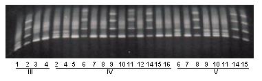 En el estudio de esta familia se puede apreciar, además de la co-segregación de la mutación con la enfermedad, que los individuos identificados en el árbol como.1, V.2, V.4, V.6, V.9, V.10 y V.