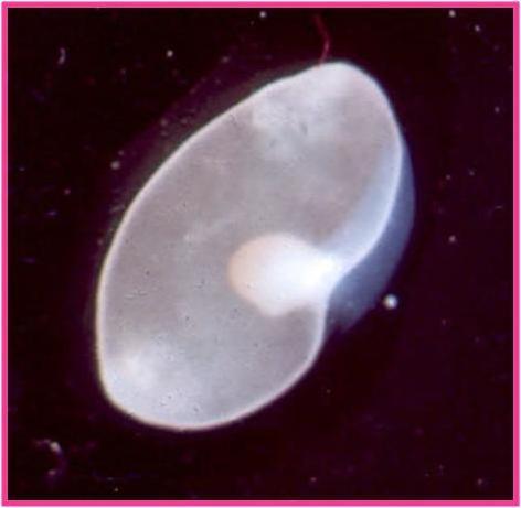 Agente causal Cisticercos de Taenia solium, que pueden presentarse de dos formas: Vesicular: Es la más frecuente.