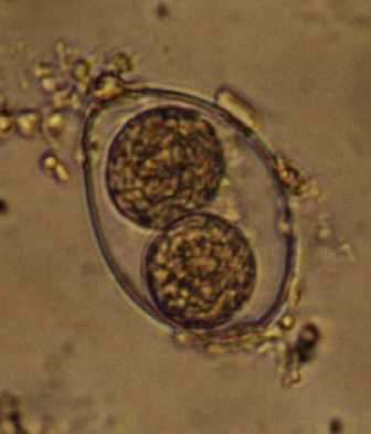 Isospora belli : biología - ooquiste 20-30 um de largo esporoblasto (recién emitido)