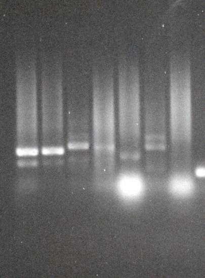 Detección del agente Detección del DNA: mediante técnica de PCR en