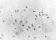 fagocitosis, de antígenos y de los