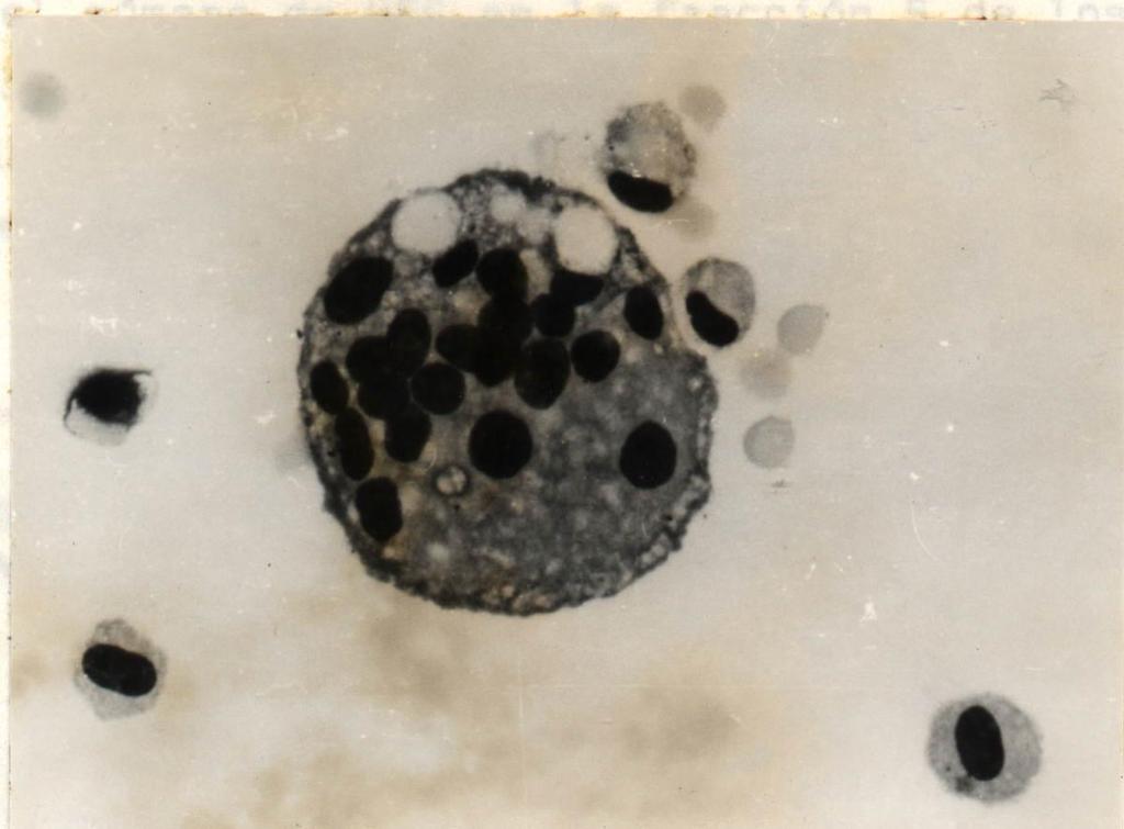 TB: patogénesis Células