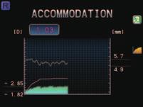 Medida de la Acomodación amigable con el paciente (disponible para ARK-1s, ARK-1a, AR-1s, y AR-1a) Medida de Acomodación con Algoritmo de Inteligencia Artificial La medición objetiva de la