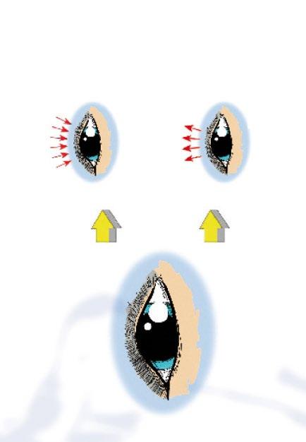 Acuaiss Baño ocular Baño ocular con ácido hialurónico Limpieza de los ojos e hidratación en un solo paso Acuaiss Baño ocular es una solución que contiene suero fisiológico con ácido hialurónico.