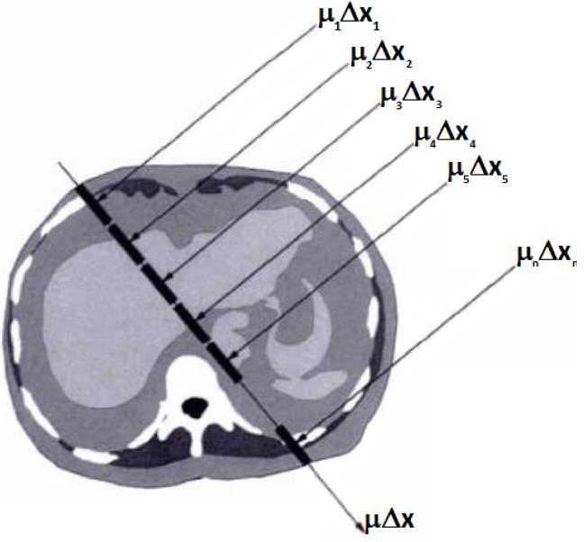iguales al píxel en el plano de la imagen y su tercera dimensión representa el espesor del corte de barrido del CT Figura 2.