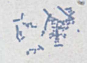 Cromosomas B Cromosomas de