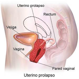 vagina.