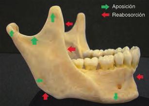 Procedimientos para el análisis radiográfico / 157 Superposición maxilar La posición anteroposterior del maxilar es determinada por una estructura primaria: Proceso cigomático: entre el reborde