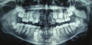 166 \ Manual de historia clínica odontológica del escolar [19] Hägg U, Taranger J. Maturation indicators and the pubertal growth spurt. Am J Orthod Dentofacial Orthop. 1982;82(4):299-309.