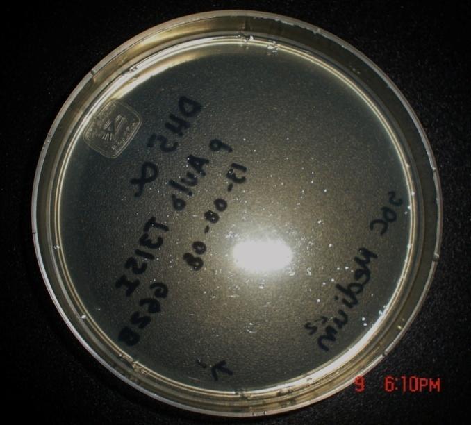 6.2 Lisis alcalina y extracción del plásmido 5 4 6 7 1 3 2 Figura 6.2. Fotografía de la placa con medio S.O.C. con células DH5α transformadas con paulo- T315I.