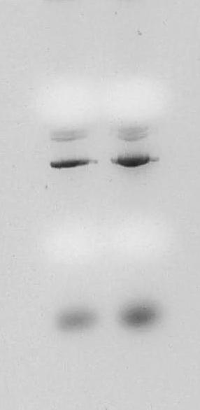 paulo-t315i 1 2 OC L CCC trna Figura 6.5. Plásmido paulo-t315i obtenido de lisis alcalina de la clona 4.