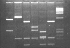Cuba de electroforesis ADN, ARN Tinción: Bromuro etidio (UV) SYBR