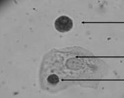 Enterobius vermicularis u Oxiuros Se observan