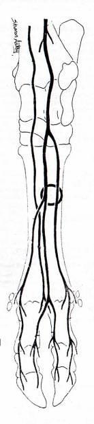 Inervación pie bovino Muy similar a equino, aunque mayor número de nervios digitales. El N. Tibial se divide en N. Plantares lateral y medial, el lateral da un ramo profundo, no hay N.
