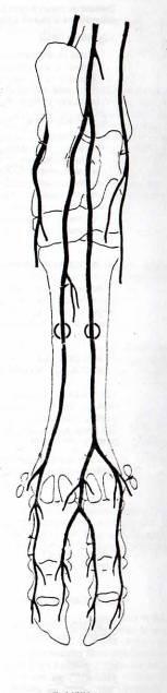 La inervación de los dedos es similar al Mb torácico. N. Fibular profundo N. Fibular superficial N. Dig dorsal común II N. Dig dorsal común III N. Sural cutáneo caudal N. Plantar lateral N.
