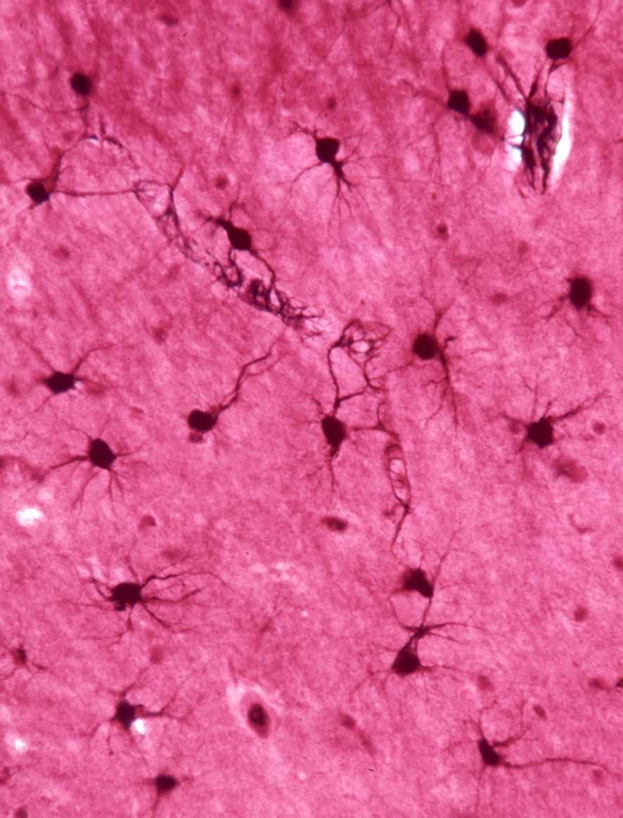 33. Estas células con escasas prolongaciones son: a) Neuronas multipolares