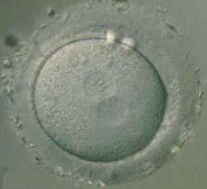 Fecundación Zigoto (óvulo fecundado) Trompas Día 3 Mórula (varios